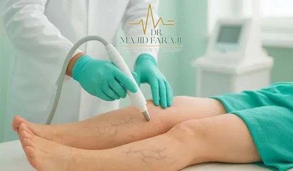 درمان واریس