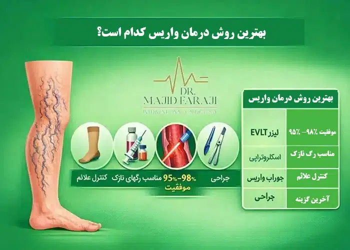 راهکارهایی برای درمان واریس