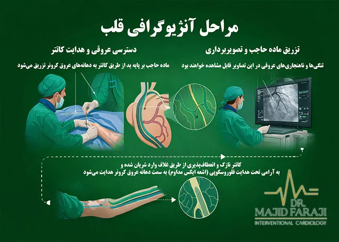 تصاویر مراحل آنژیوگرافی قلب