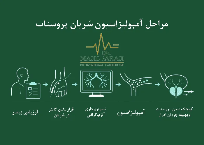 آمبولیزاسیون شریان پروستات (PAE)