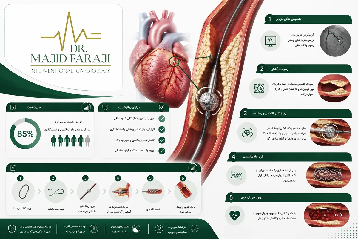 روش مته الماس قلب