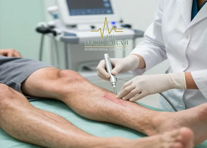 هزینه اسکلروتراپی واریس پا