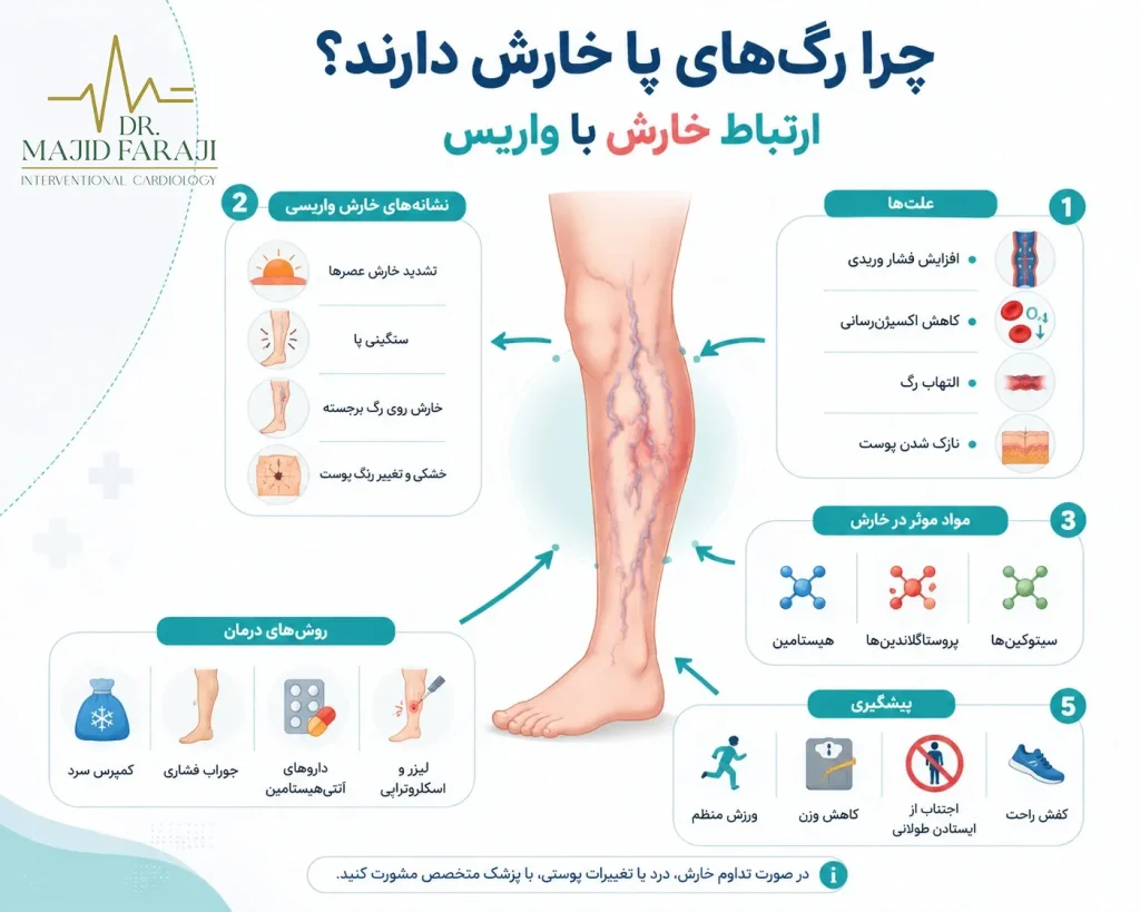 پیشگیری از بروز خارش واریس پا