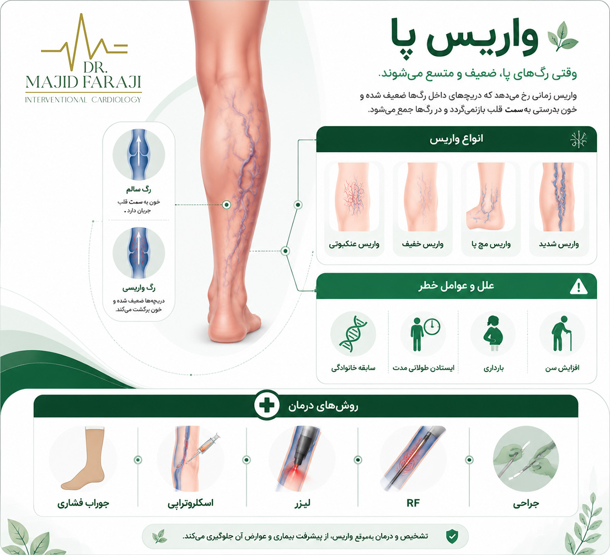 انواع واریس