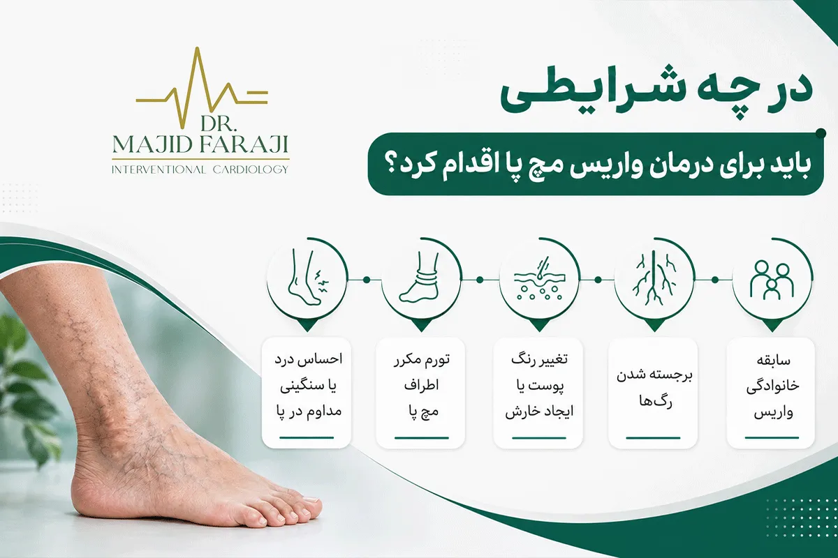 علائم واریس مچ پا در زنان