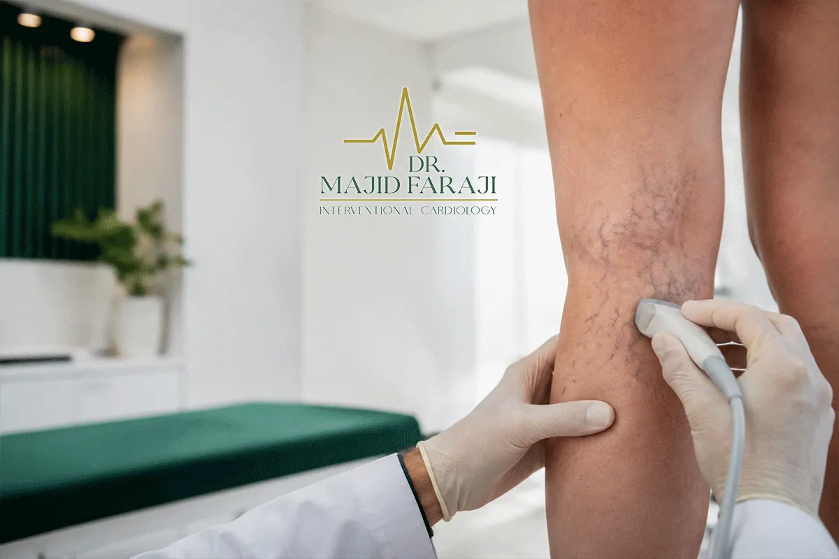 درمان واریس پشت زانو چگونه انجام می‌شود؟ بررسی علت، علائم و روش‌های درمان