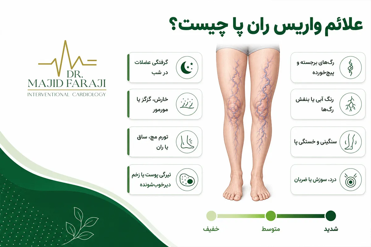 واریس ران پا خطرناک است؟