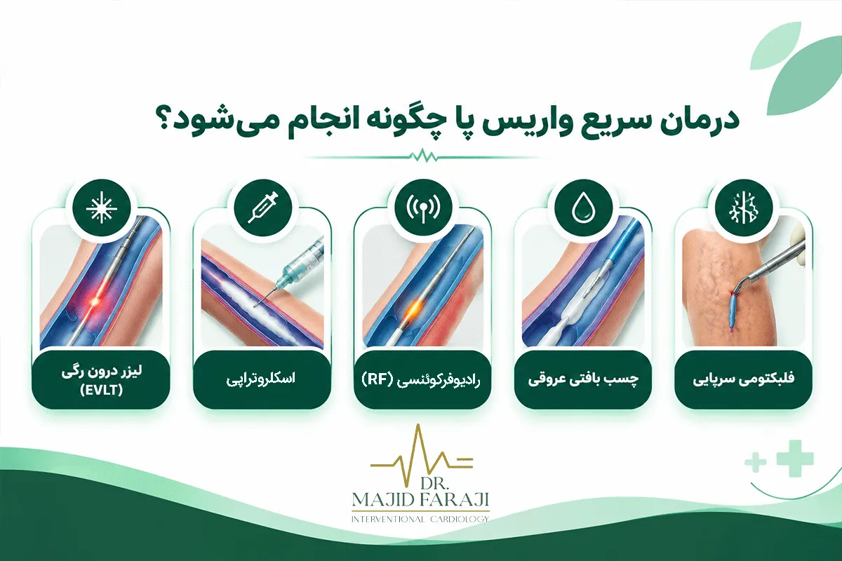آیا واریس پا در یک جلسه درمان میشود؟