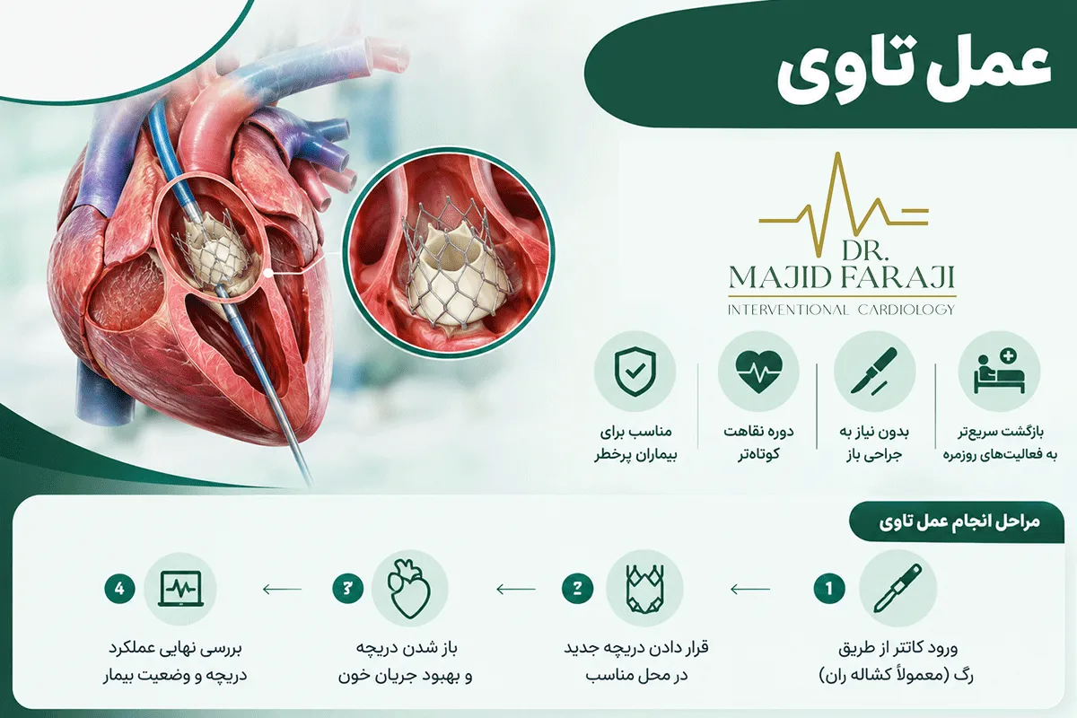 بهترین فوق تخصص اینترونشنال کاردیولوژی برای عمل تاوی در تهران