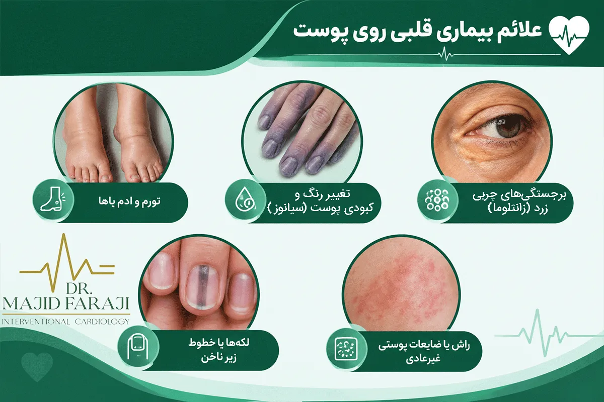 علت کبودی خود به خود بدن